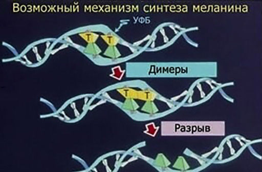 Загар или повреждение