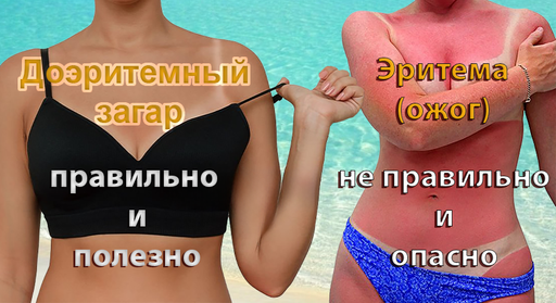 Доэритемный, значит грамотный загар